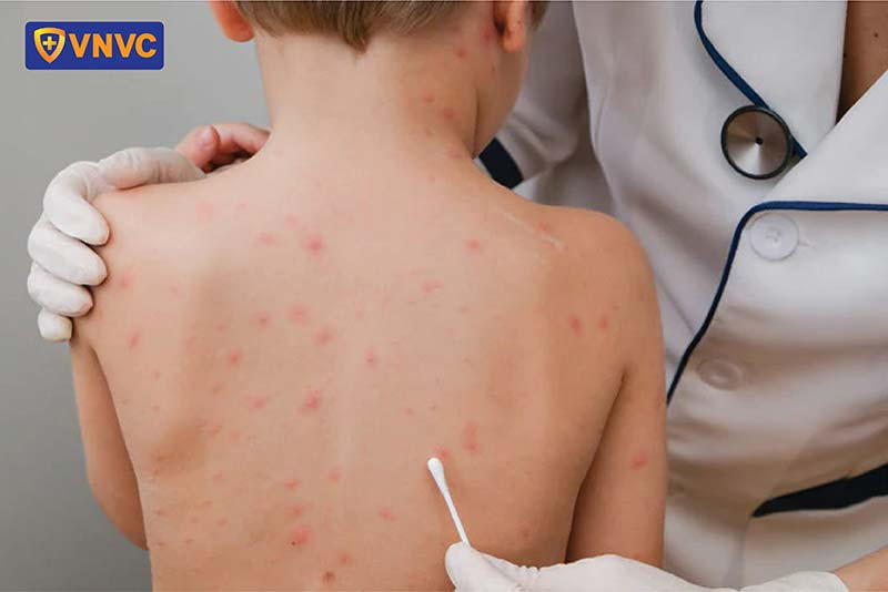 Chăm sóc nhẹ nhàng vùng da bị sẹo giúp thúc đẩy quá trình phục hồi da