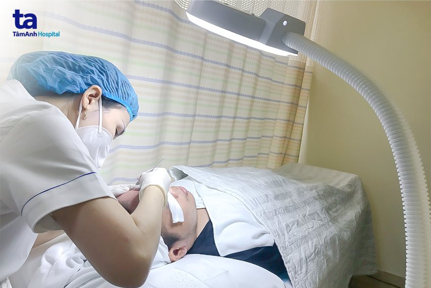 Chuyên gia thực hiện chấm TCA trong liệu trình trị sẹo hiệu quả cho sẹo đáy nhọn