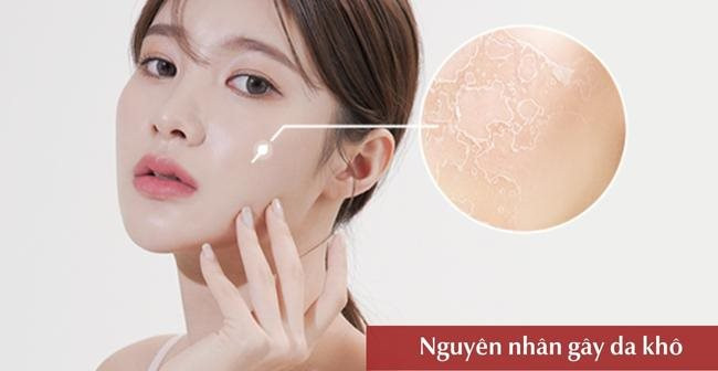 Nhiều yếu tố bên ngoài và bên trong cơ thể có thể là nguyên nhân khiến da khô