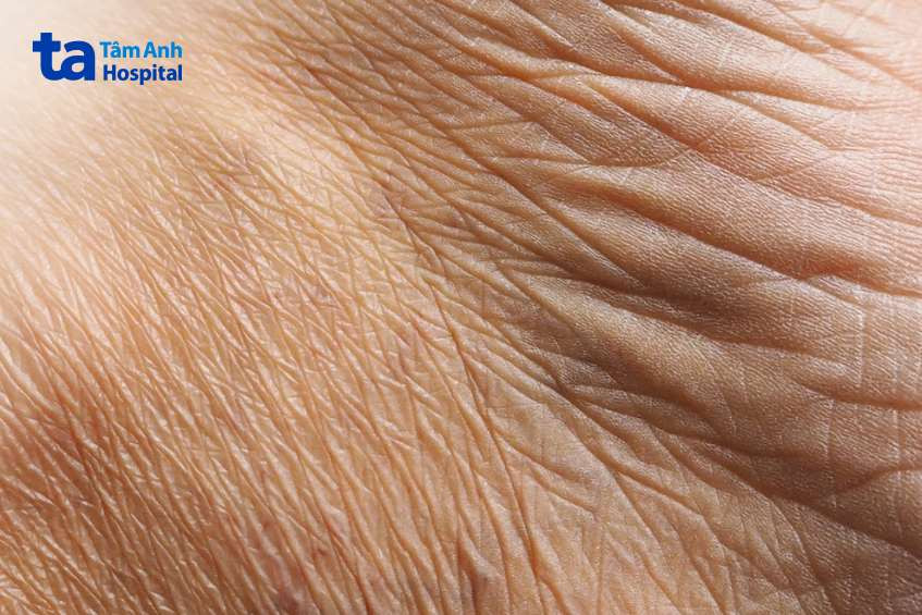 Dấu hiệu lão hóa da và các bước làm đẹp da nhanh chóng để cải thiện