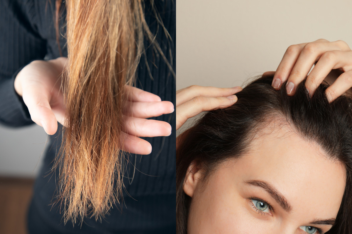 Massage da đầu giúp thư giãn và cải thiện tuần hoàn máu