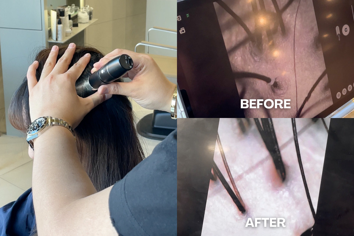 Các bước trong quy trình spa da đầu Hàn Quốc