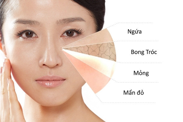 Da khô thường xuất hiện với các dấu hiệu như bong tróc, ngứa ngáy và khó chịu.