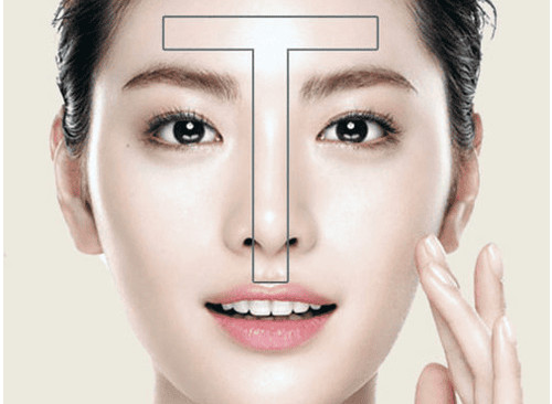 Vùng chữ T trên mặt thường dễ bị dầu