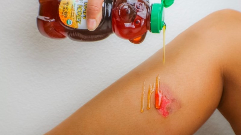 Chăm sóc da bằng mật ong giúp làm mờ sẹo thâm và tái tạo tế bào da mới