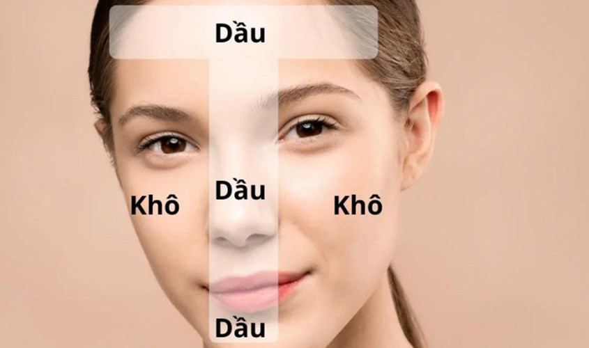 Minh họa làn da hỗn hợp với các vùng da dầu và khô khác biệt trên khuôn mặt.