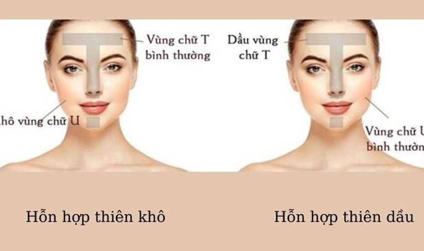 Sơ đồ so sánh đặc điểm da hỗn hợp thiên dầu và da hỗn hợp thiên khô.