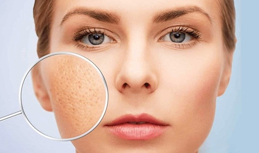 Cô gái chăm sóc da hỗn hợp dưới ánh nắng mùa hè.