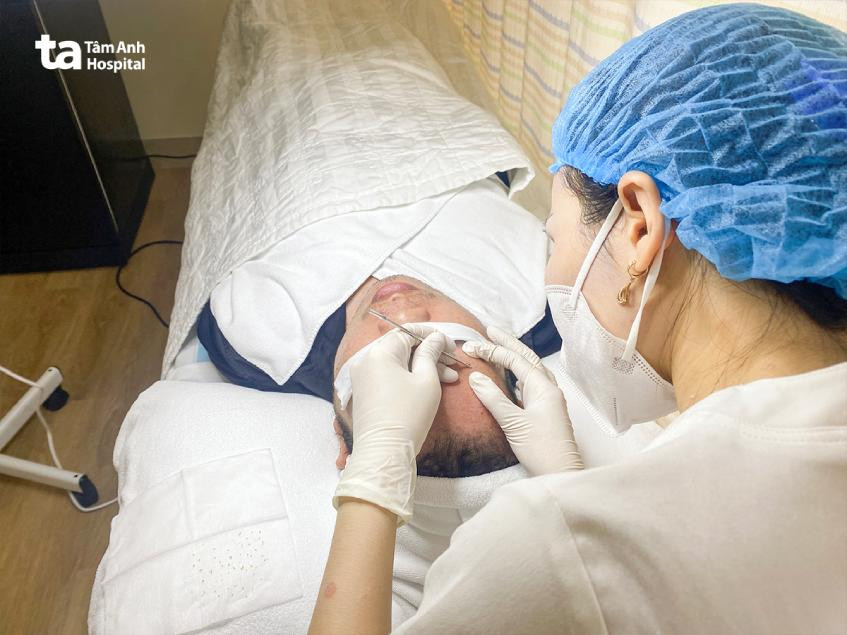 Khách hàng đang được thăm khám và điều trị mụn cám tại chuyên khoa da liễu, bệnh viện đa khoa