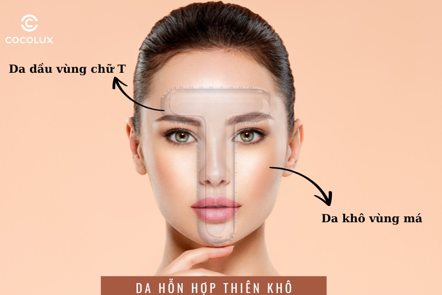 Khuôn mặt có vùng da hỗn hợp thiên khô với má khô và vùng chữ T dầu