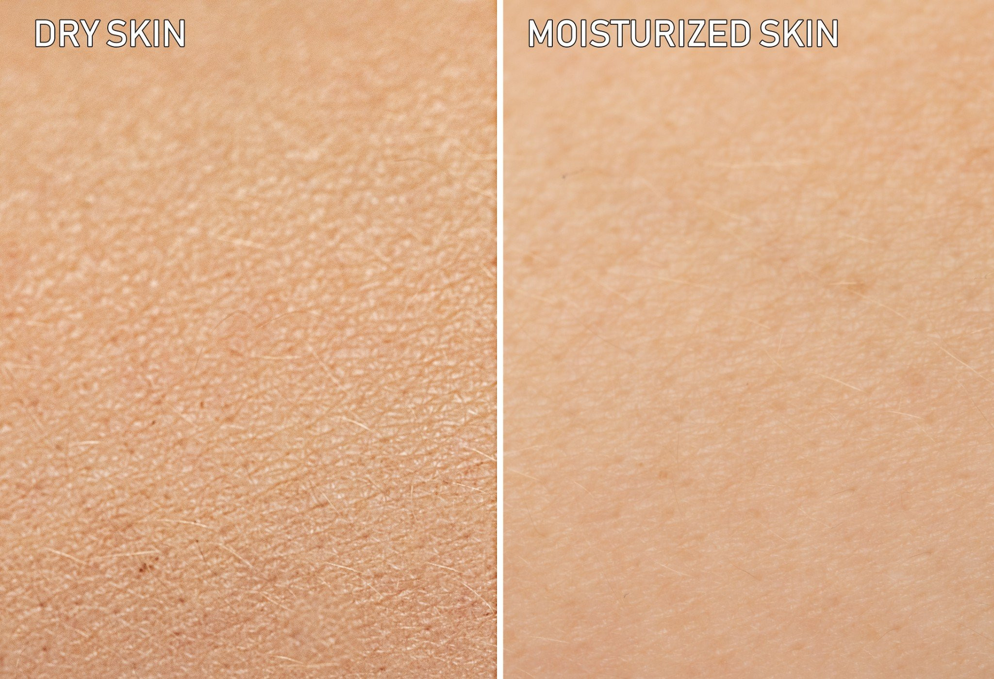 Nguyên nhân phổ biến gây khô da và tầm quan trọng của việc dưỡng ẩm