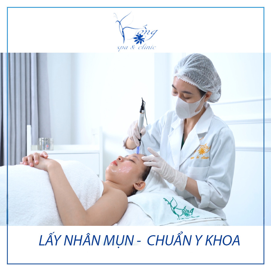 chuyên gia đang tư vấn về tác hại của việc không nặn mụn ẩn kịp thời, cần lưu ý khi xem video nặn mụn ở spa