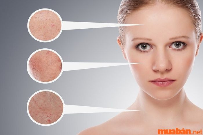 Chuyên viên spa cần kiến thức về da để học ngành spa thành công