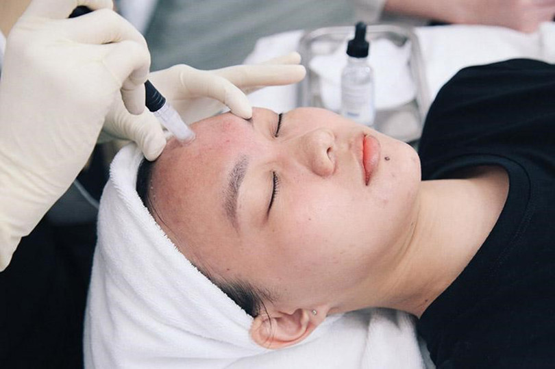 Chuyên viên spa đang thực hiện liệu trình phi kim điều trị mụn cho khách hàng