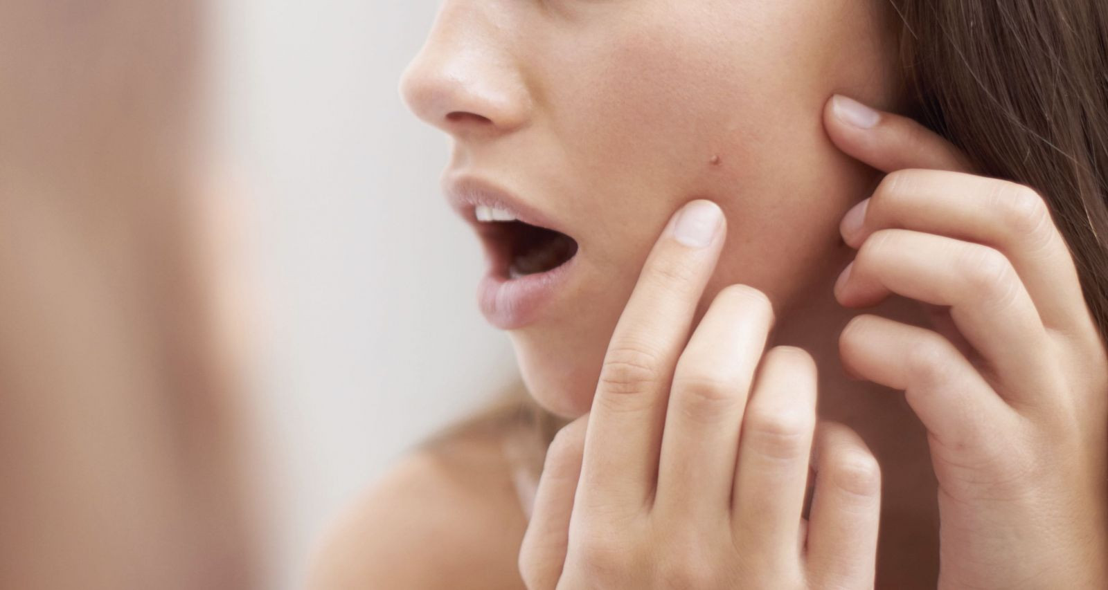 Cô gái với gương mặt mụn đang lo lắng