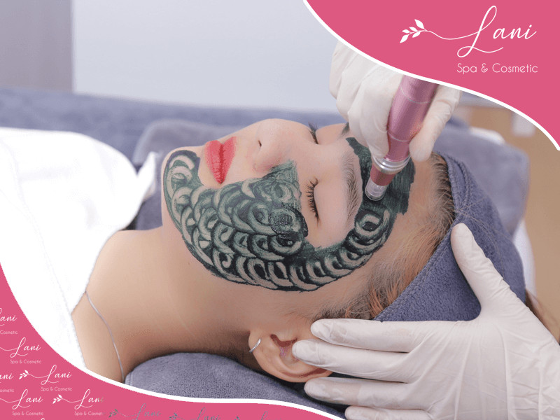 Công nghệ ánh sáng sinh học trị mụn tại spa