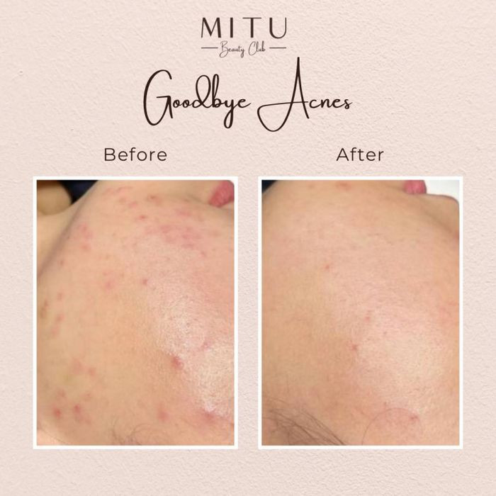 Đội ngũ chuyên viên tận tâm tại Hội Viên Làm Đẹp MITU