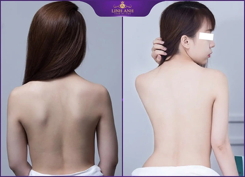 Gương mặt rạng rỡ của khách hàng sau khi trải nghiệm liệu trình tắm trắng chuyên sâu tại spa.