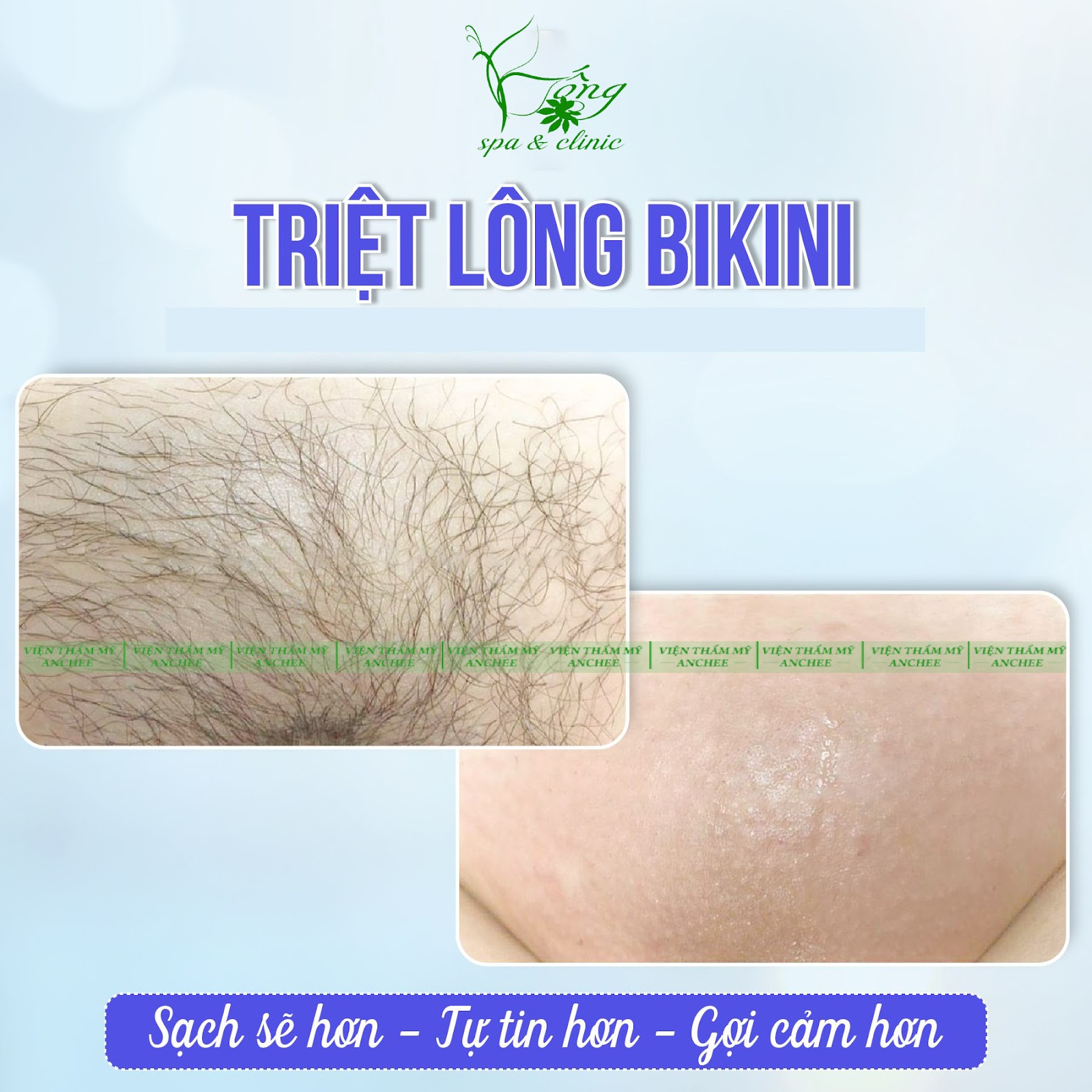 Khách hàng thư giãn trong quá trình spa tỉa lông vùng kín, hình ảnh thể hiện sự chuyên nghiệp và thoải mái