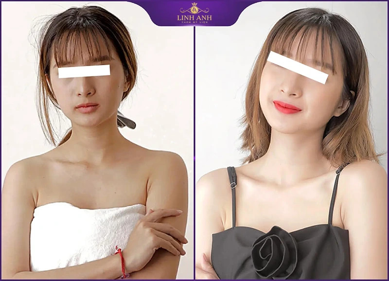 Khách hàng tự tin khoe làn da sáng khỏe, đều màu sau khi tắm trắng tại spa chuyên nghiệp.