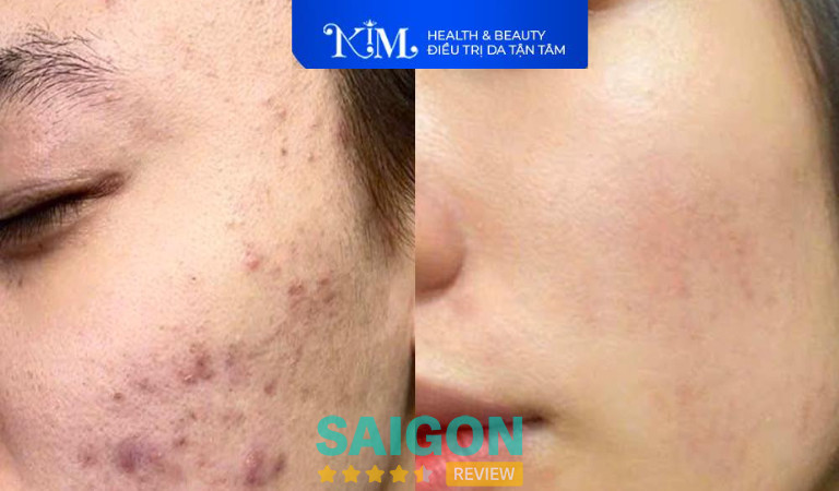 Kim Health &amp; Beauty tại TPHCM