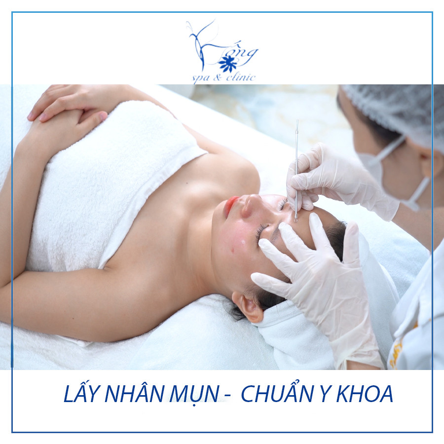 kỹ thuật viên chuyên nghiệp tại spa đang thực hiện quy trình lấy nhân mụn an toàn, đảm bảo hiệu quả cho khách hàng