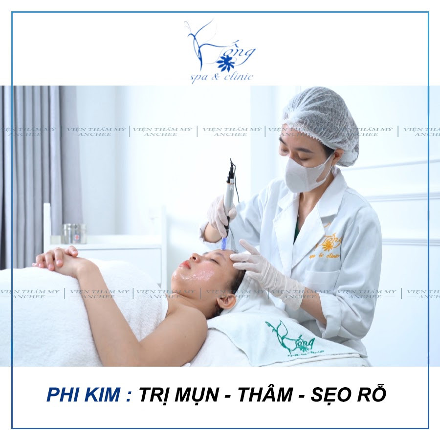 liệu trình phi kim trị mụn đang được thực hiện, một công nghệ tiên tiến thường được giới thiệu trong video nặn mụn ở spa