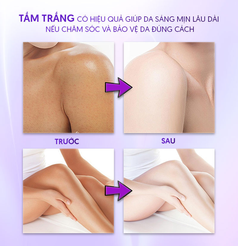 Người phụ nữ với làn da trắng sáng, mịn màng sau liệu trình tắm trắng tại spa, minh chứng cho hiệu quả tích cực của phương pháp này.