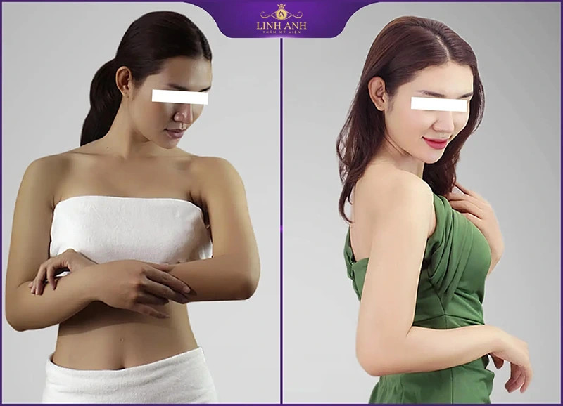 Nụ cười tươi tắn của khách hàng thể hiện sự tin tưởng vào hiệu quả tắm trắng ở spa.