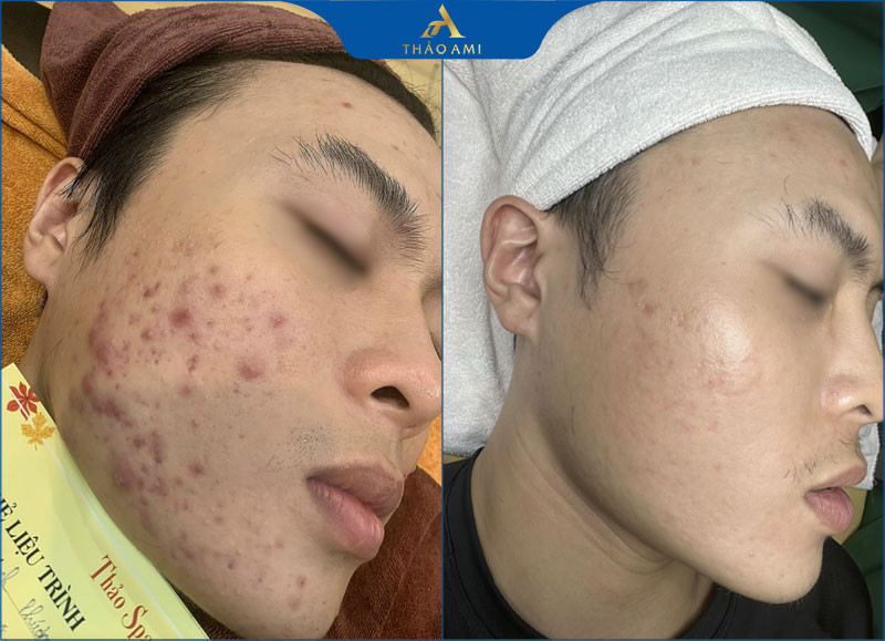 Phản hồi tích cực từ khách hàng sau liệu trình tại Clair Center Hà Nội