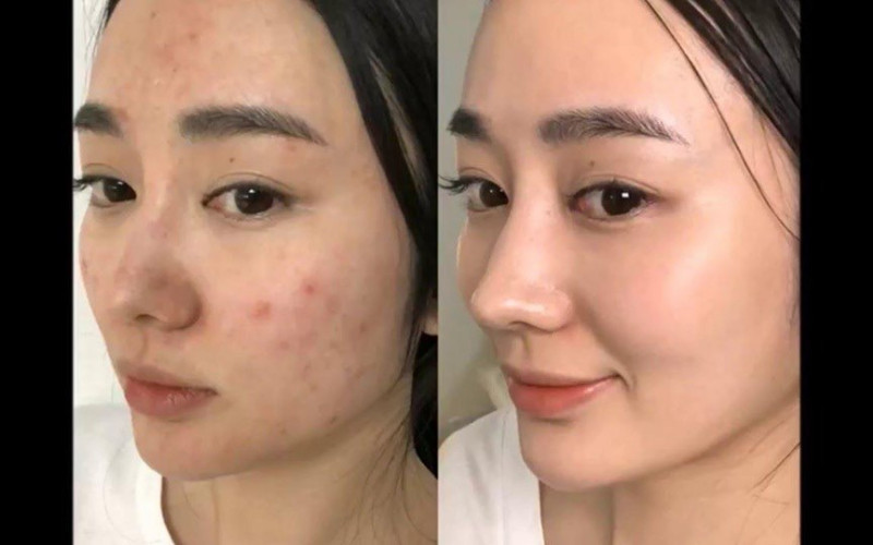 Sản phẩm tảo sinh dưỡng cao cấp dùng trong chăm sóc da tại spa