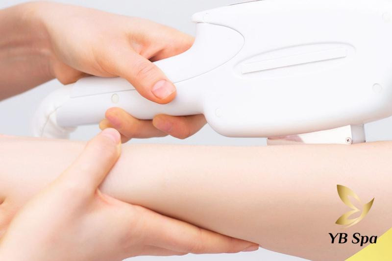 Tại spa bạn được sử dụng công nghệ cao để triệt lông