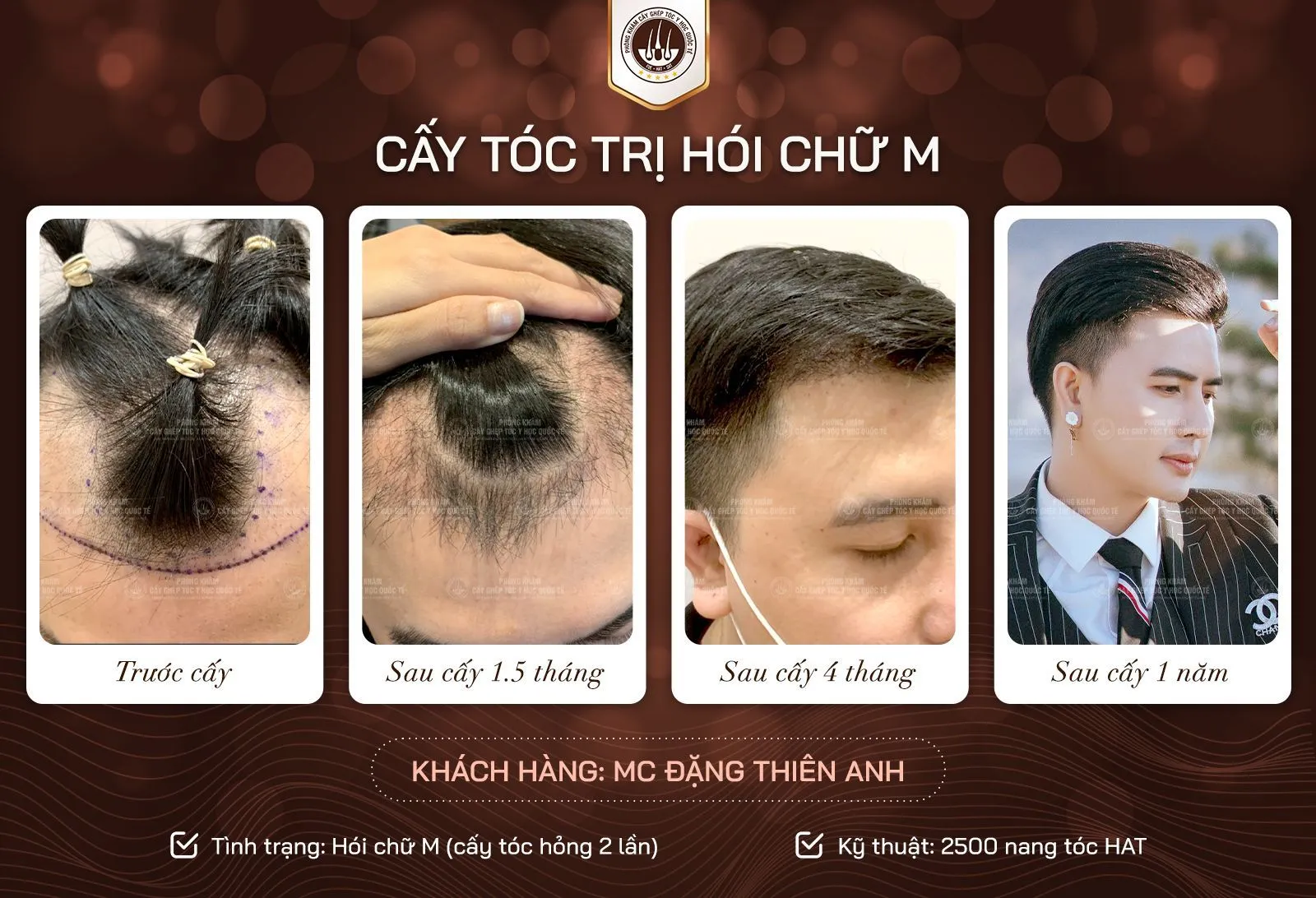 Chân dung bác sĩ chuyên khoa đang đứng trước thiết bị y tế hiện đại