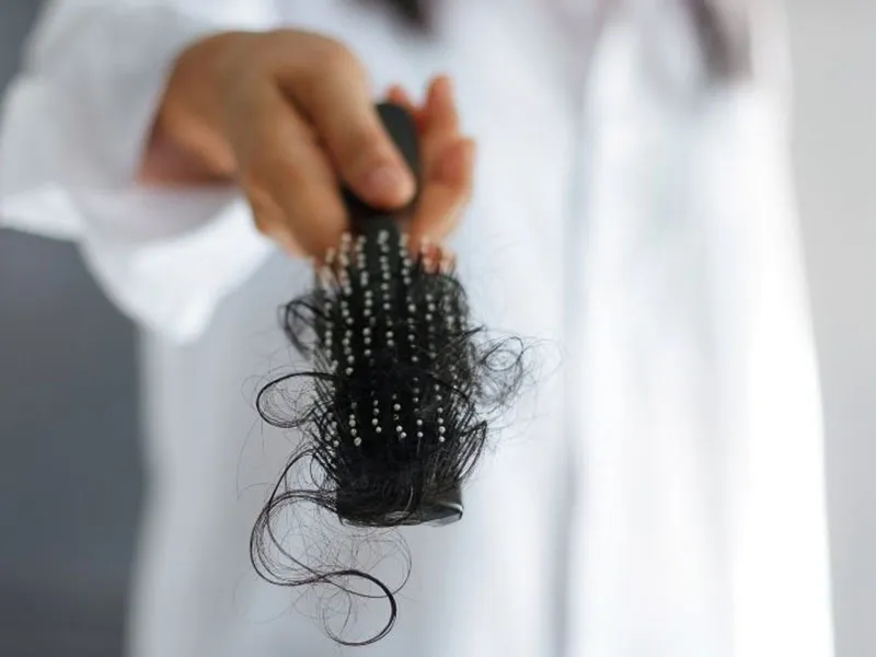 Người trung niên có nguy cơ rụng tóc cao cần áp dụng cách hạn chế tóc rụng