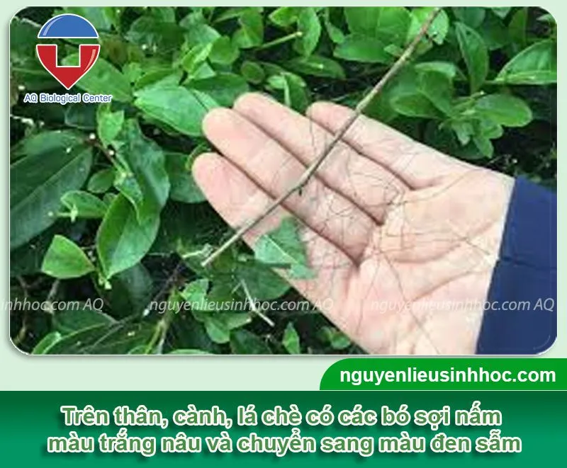 Phân biệt các dấu hiệu lâm sàng của nấm tóc Tinea Capitis