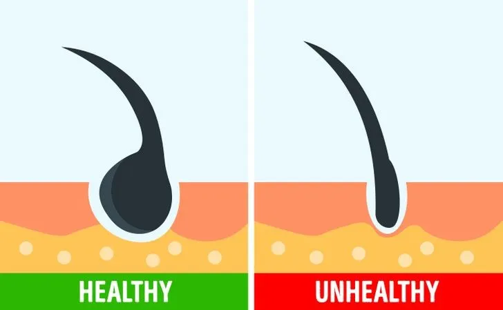 Kiểm tra phần nang tóc, hay phần củ tóc, là cách đơn giản nhất để biết tình trạng tổng thể của mái tóc yếu