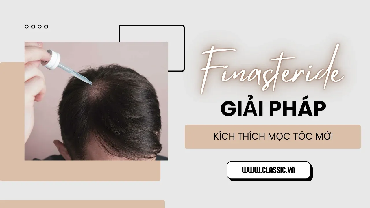 Giải pháp dùng Finasteride, một trong những cách chữa rụng tóc hói đầu hiệu quả được khoa học chứng minh