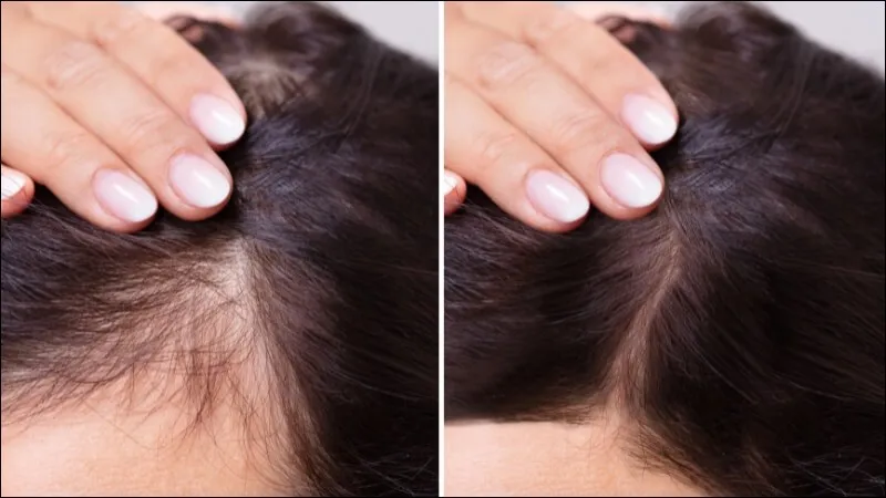 Bồ kết kích thích tóc mọc nhanh và dày hơn, hạn chế rụng tóc