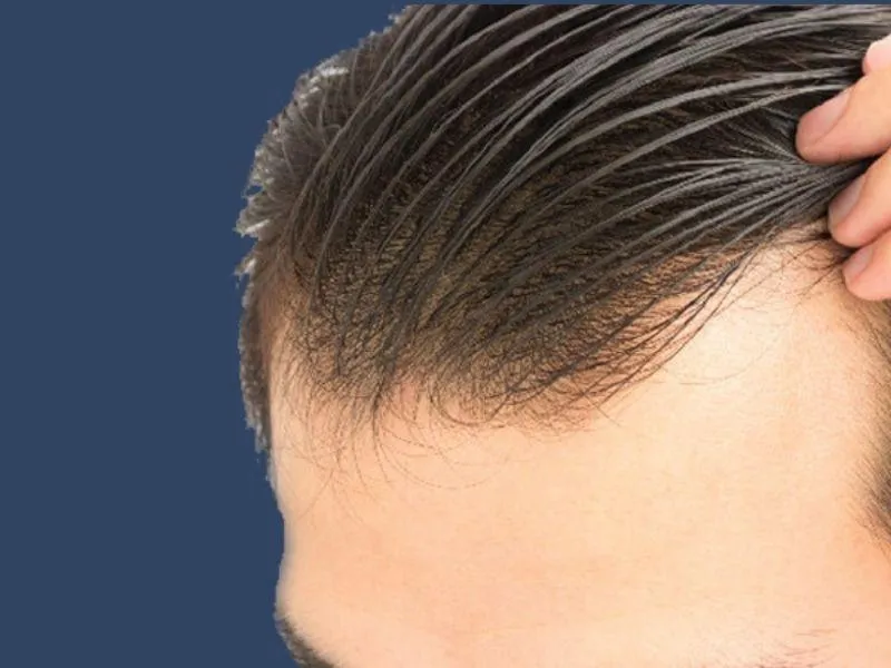 Nam giới trẻ có mái tóc phồng hiện đại và sành điệu, thể hiện phong cách năng động