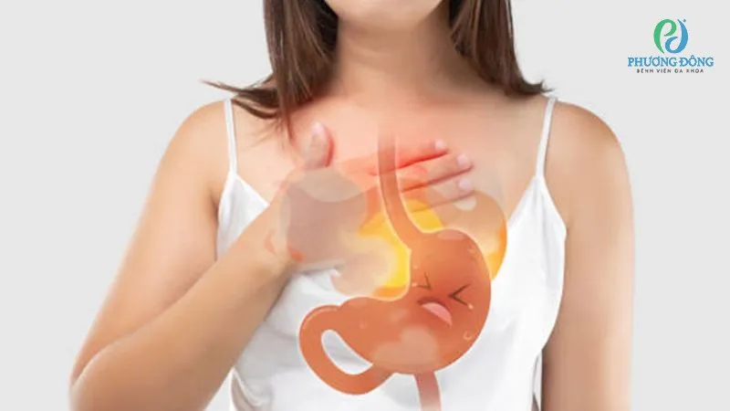 Axit do trào ngược dạ dày có thể khiến bệnh nhân bị cảm giác vướng tóc trong cổ họng