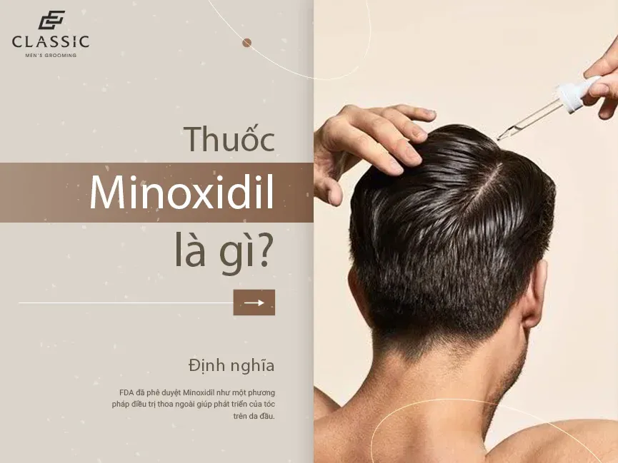 Thuốc Minoxidil 5% dưới dạng dung dịch và bọt là cách giúp mọc tóc nhiều được chứng minh hiệu quả nhất