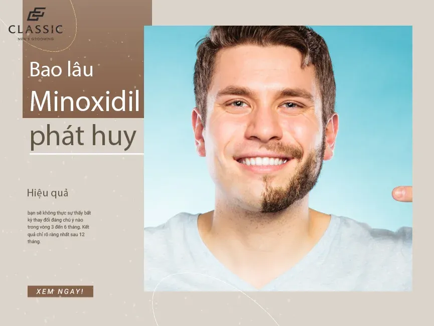 Kiên trì sử dụng Minoxidil và tuân thủ các bước chăm sóc là cách giúp mọc tóc nhiều bền vững
