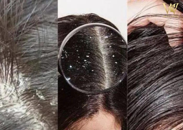 Phụ nữ đang massage da đầu nhẹ nhàng