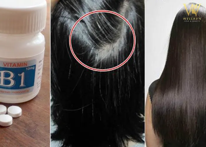 Cách chữa mồ hôi dầu ở tóc bằng viên Vitamin B1
