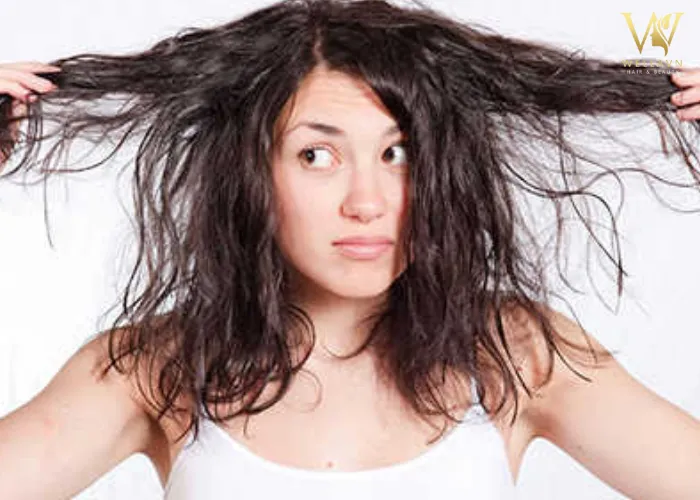 Tổng quan về nguyên nhân và giải pháp trị mồ hôi dầu ở tóc