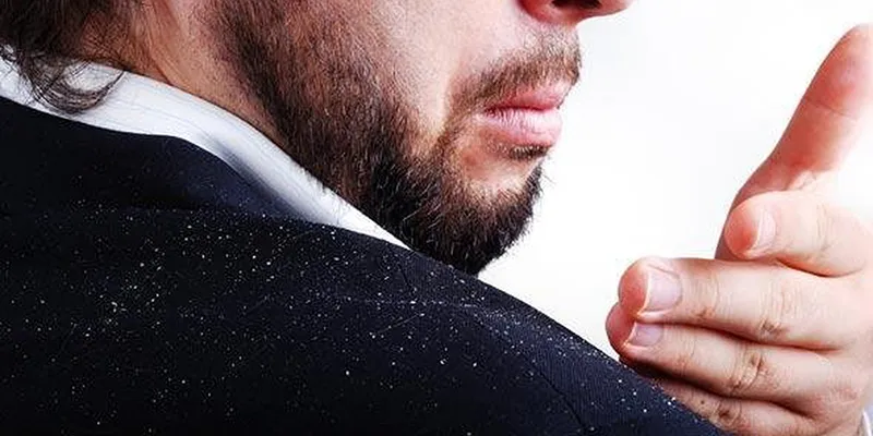 Dầu gội cho da gàu