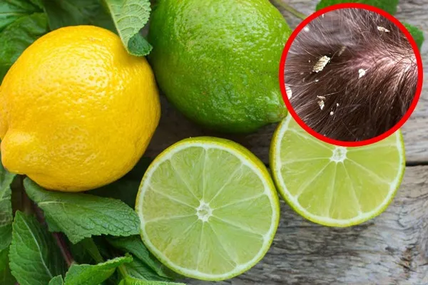 Chanh tươi chứa Axit Citric giúp cân bằng pH và hỗ trợ điều trị gàu ống hiệu quả