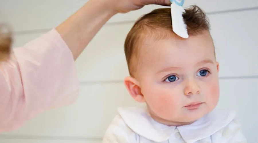 Bé gái 1 tuổi với mái tóc mọc thưa, chưa đều đang được mẹ kiểm tra.