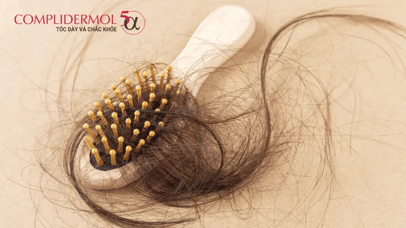 Rụng tóc là tình trạng chung hay xảy ra ở phụ nữ sau sinh