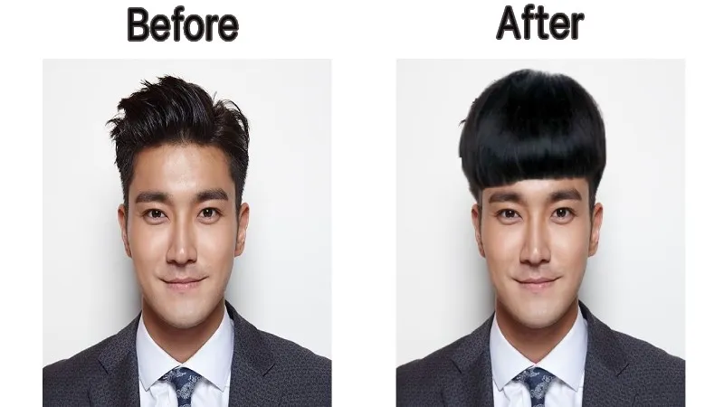 Trước và sau khi ghép tóc